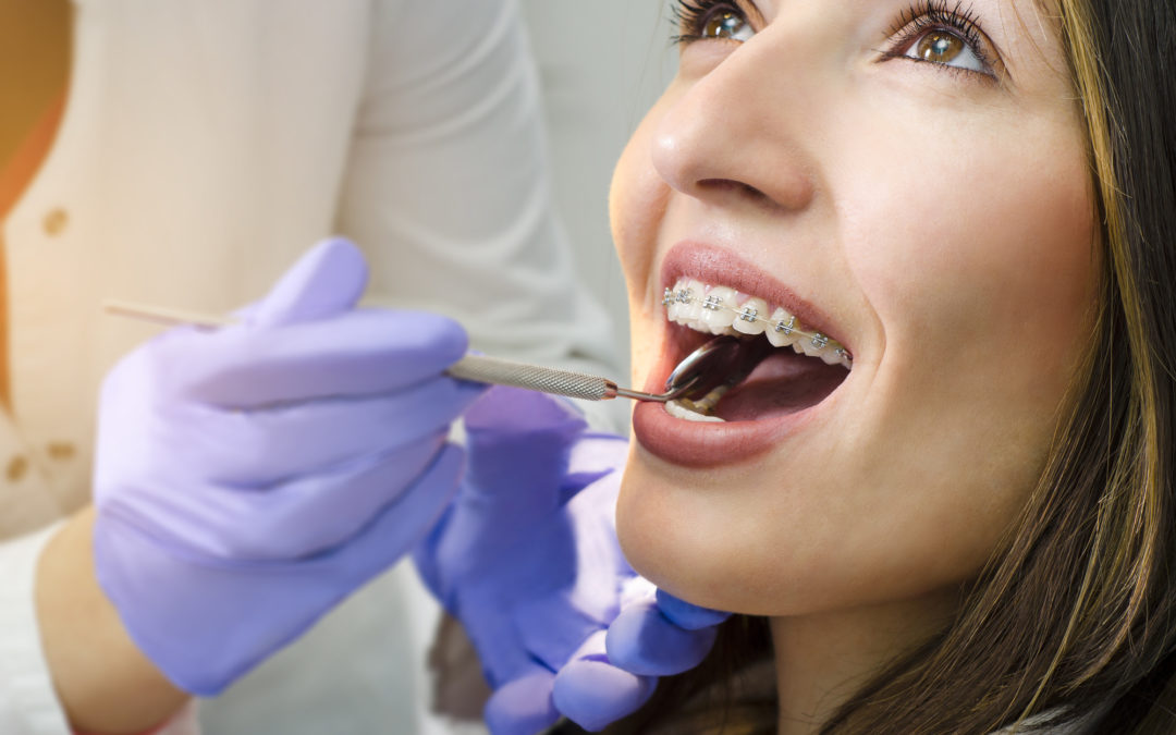 What to Consider When Choosing an Orthodontist in Lexington