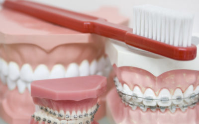 7 Adult Braces Myths Debunked