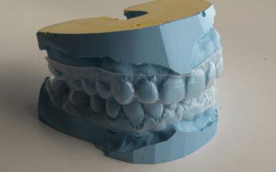 Is Invisalign Worth It for You? Benefits, Costs, and FAQs